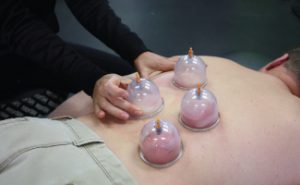 cupping-truebility-services